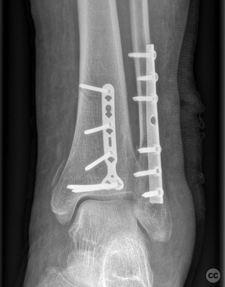 case image