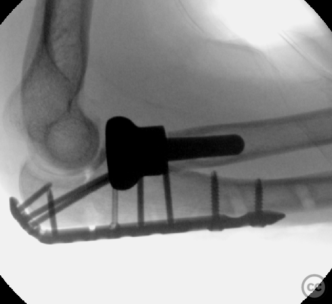 case image