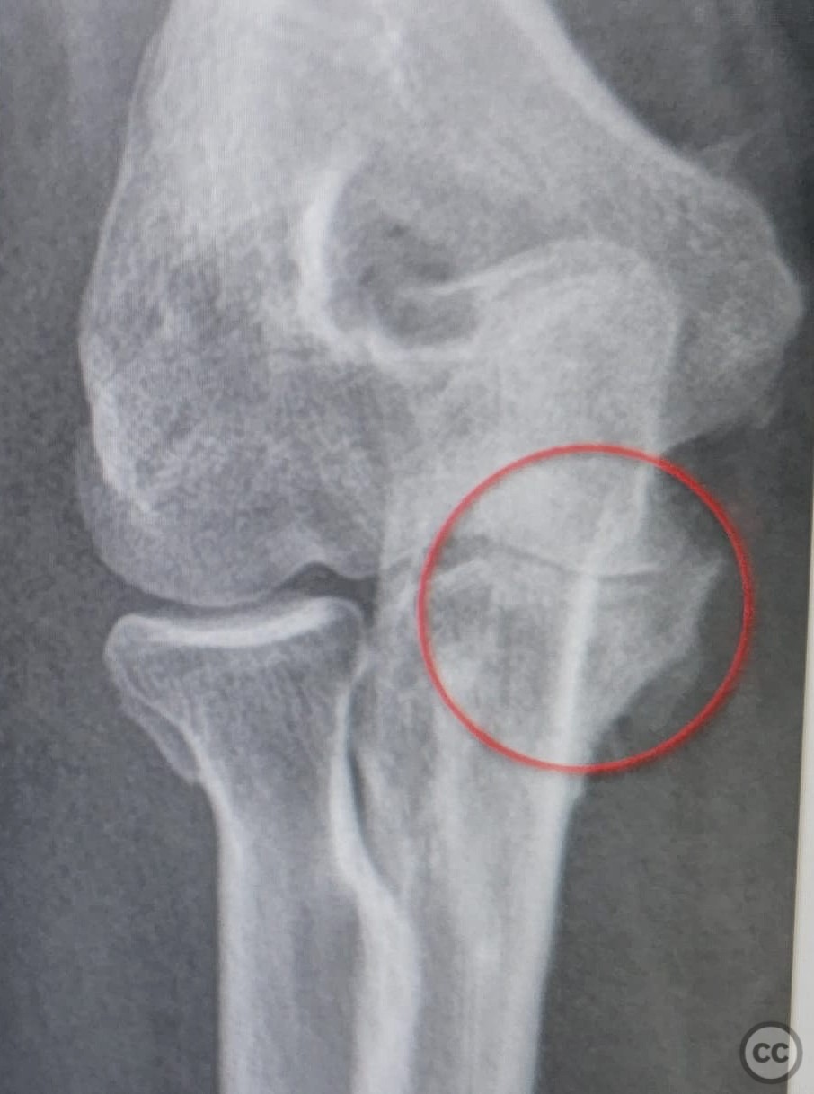 case image