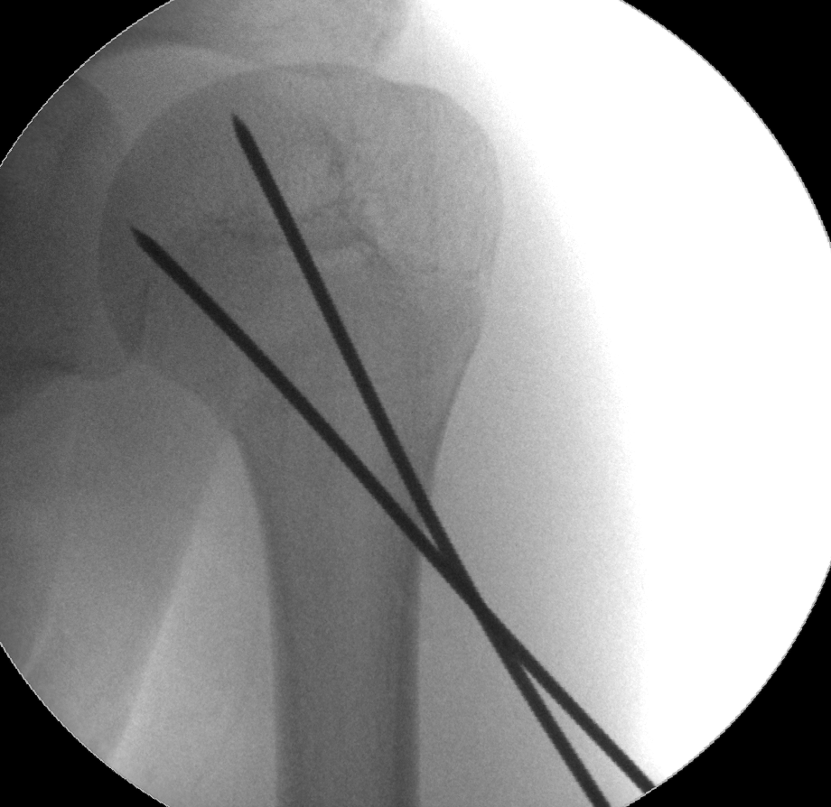 case image