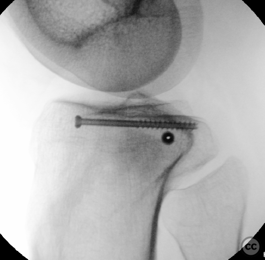 case image