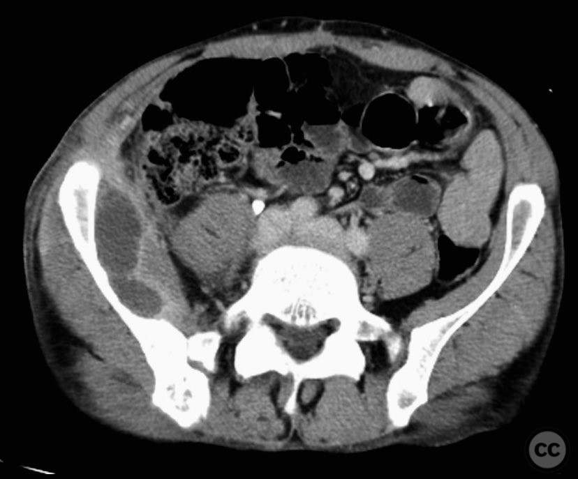 case image