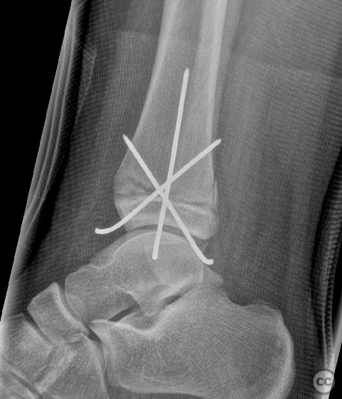 case image
