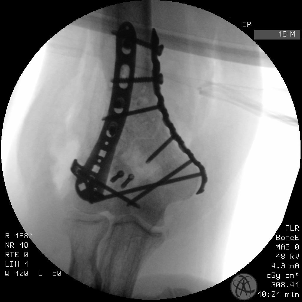 case image