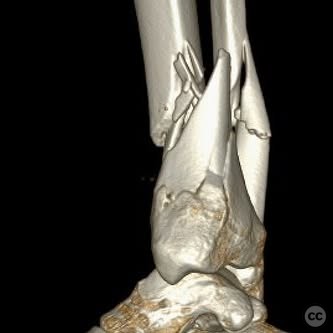 case image