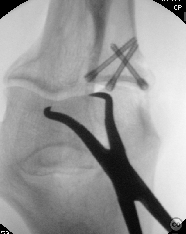 case image