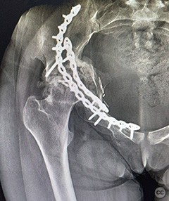 case image