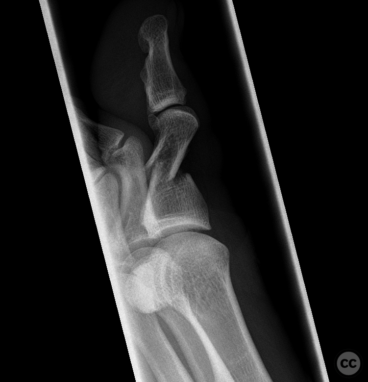 case image