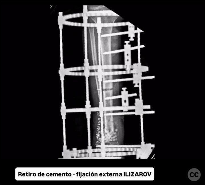 case image