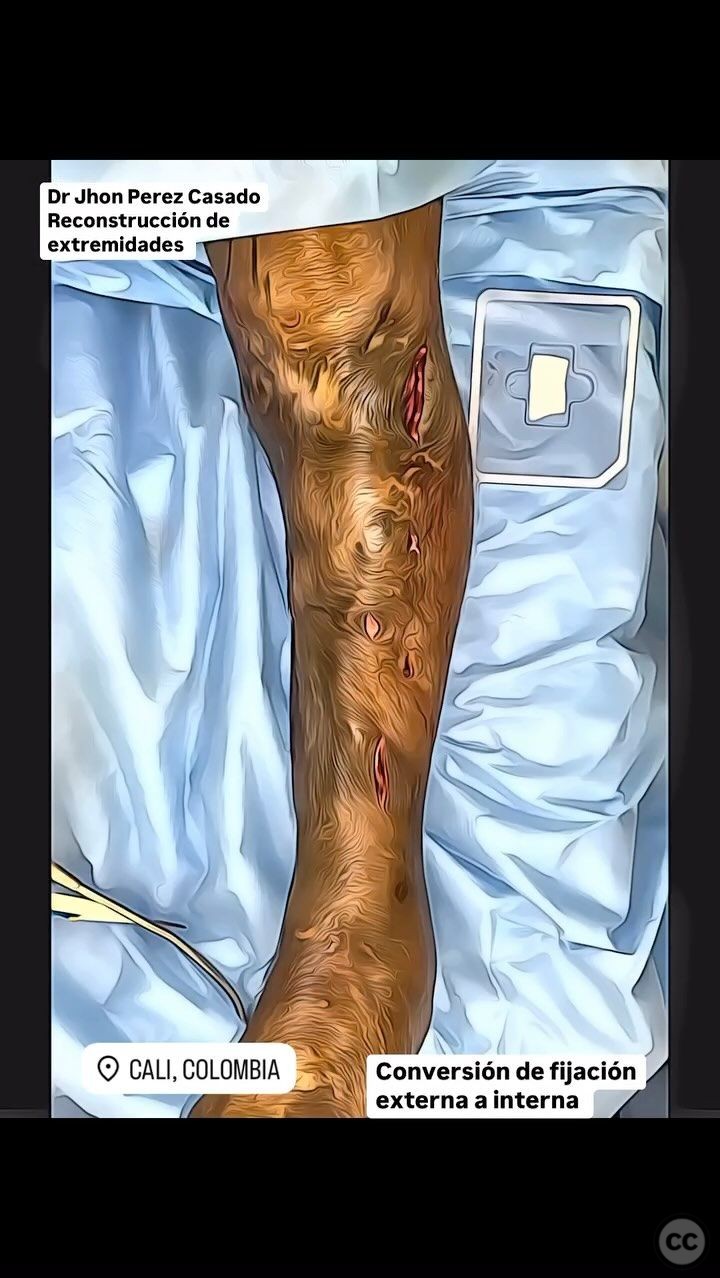 case image