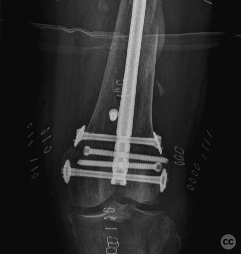 case image