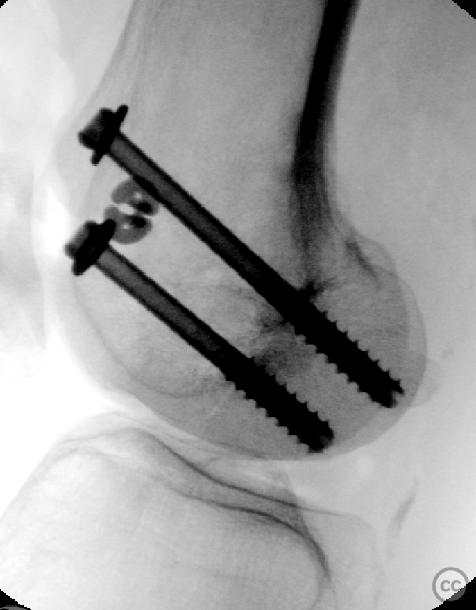 case image