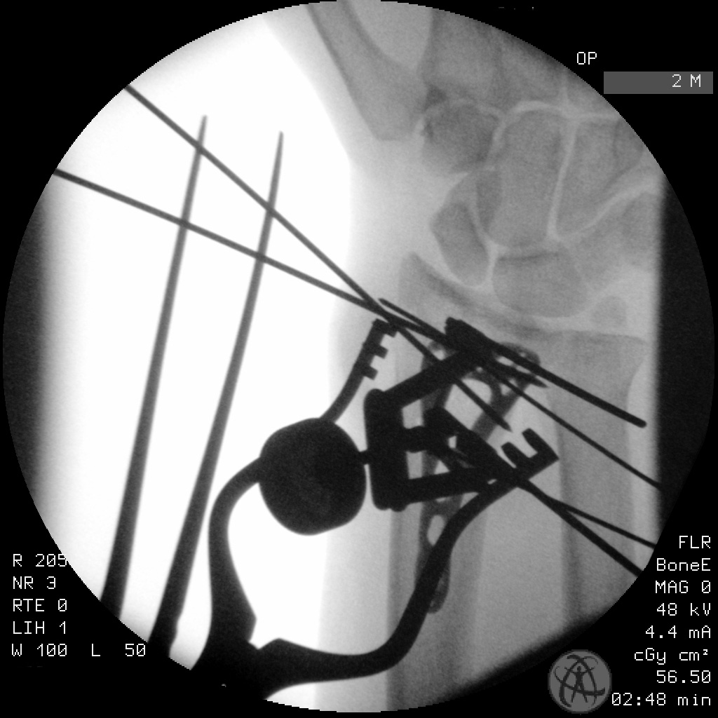 case image