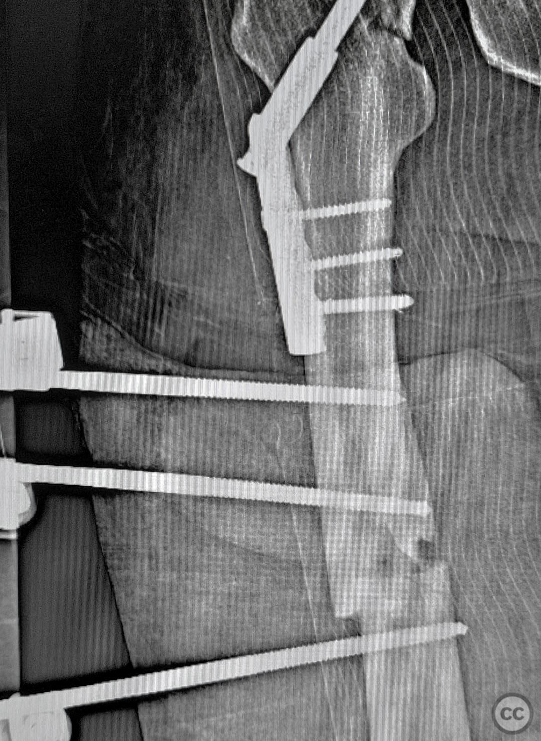 case image