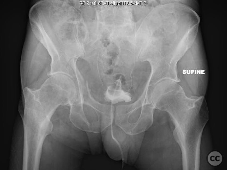 case image