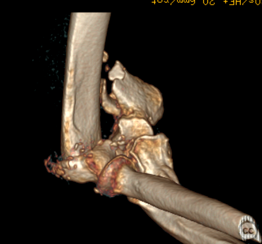 case image