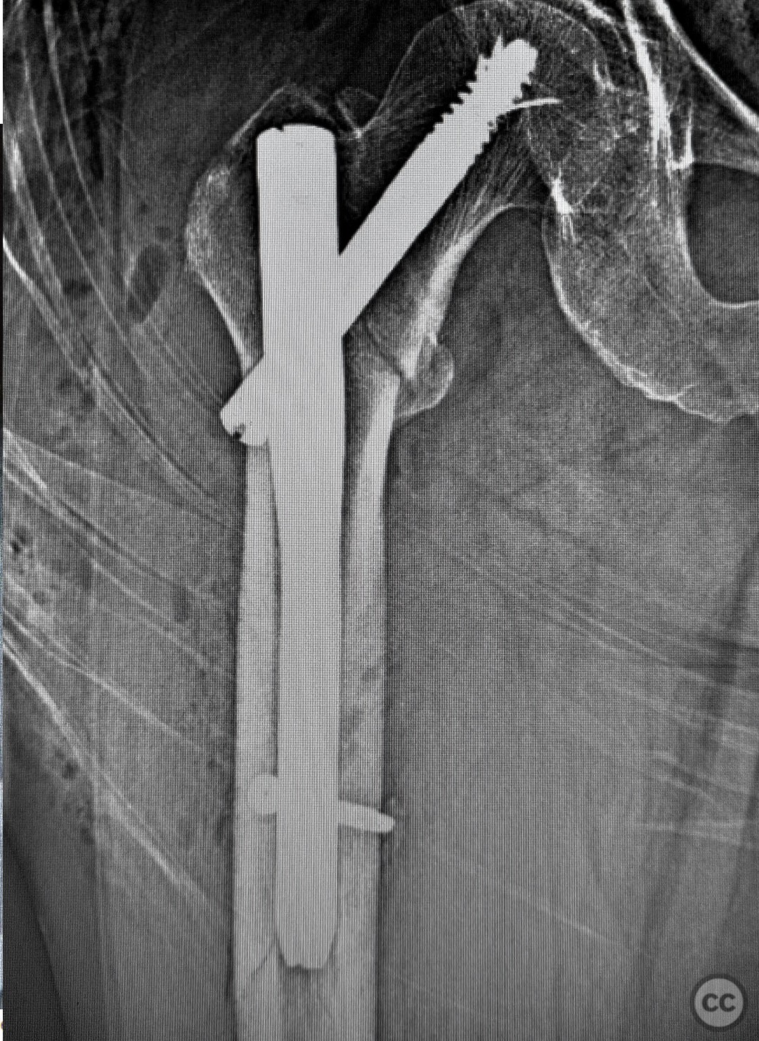 case image