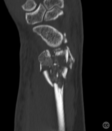 case image