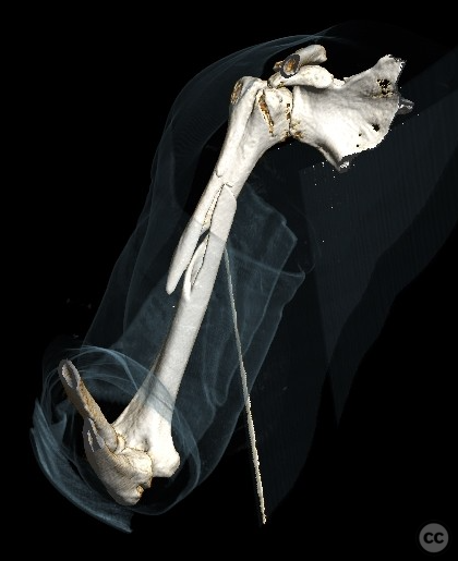 case image