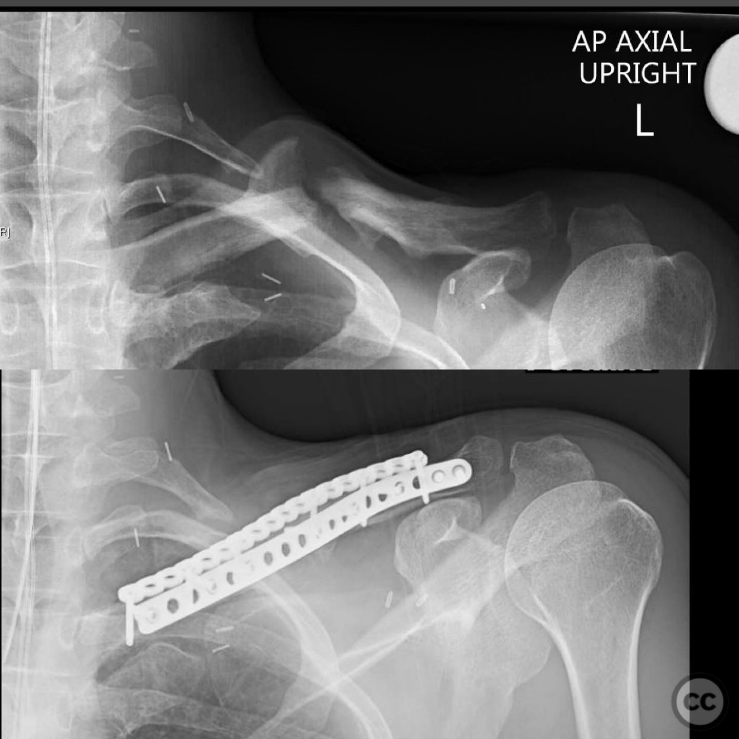 case image