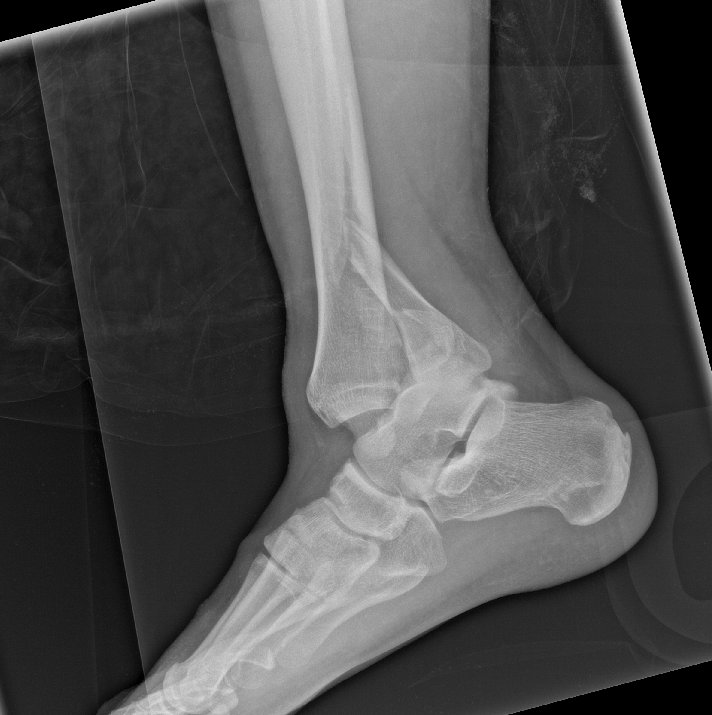 case image