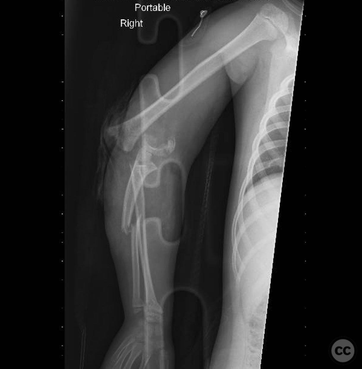 case image