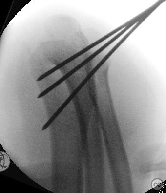 case image