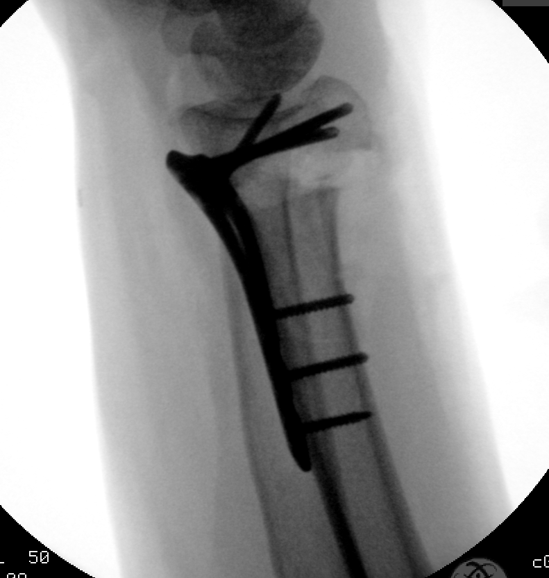 case image