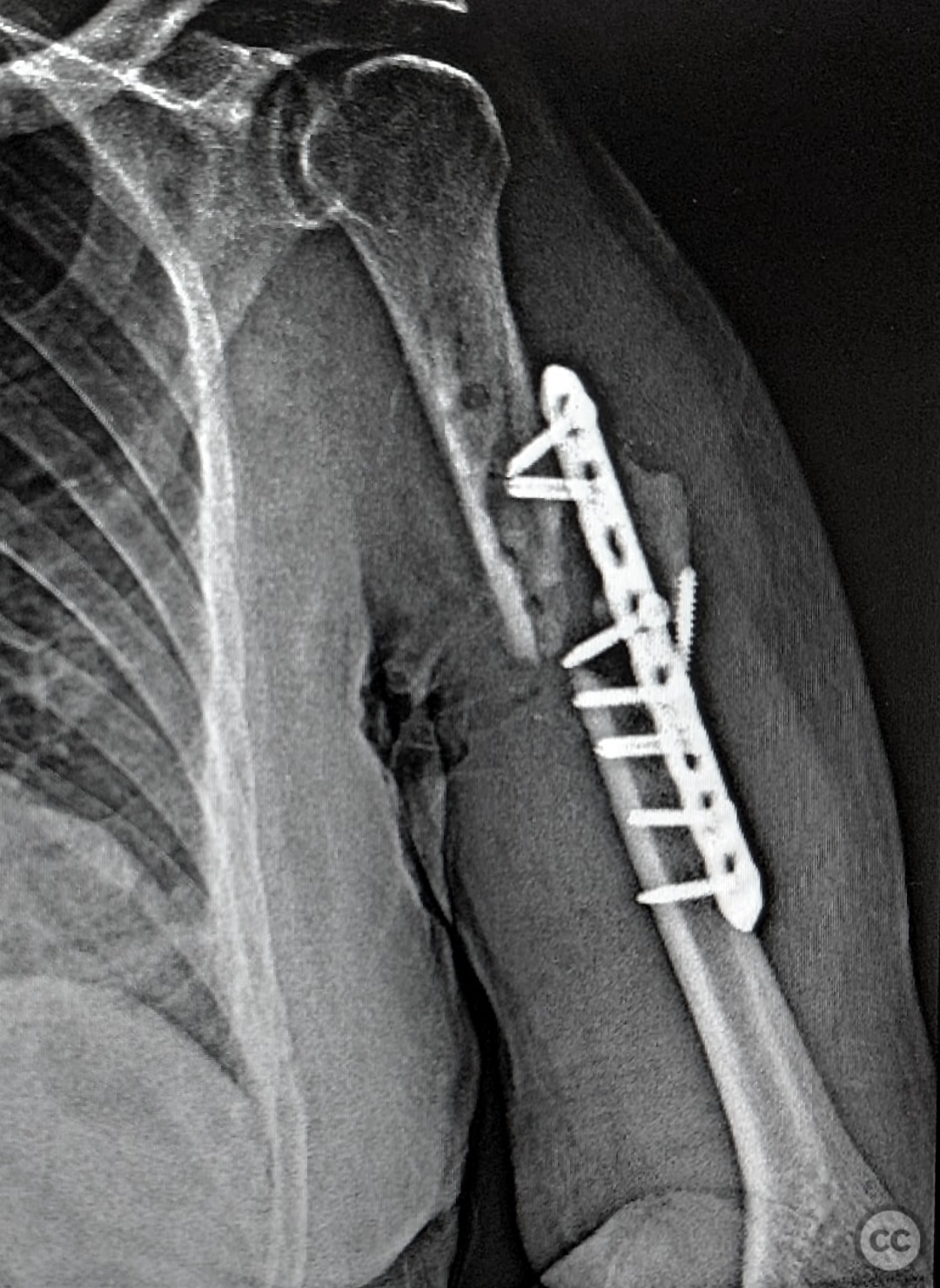 case image