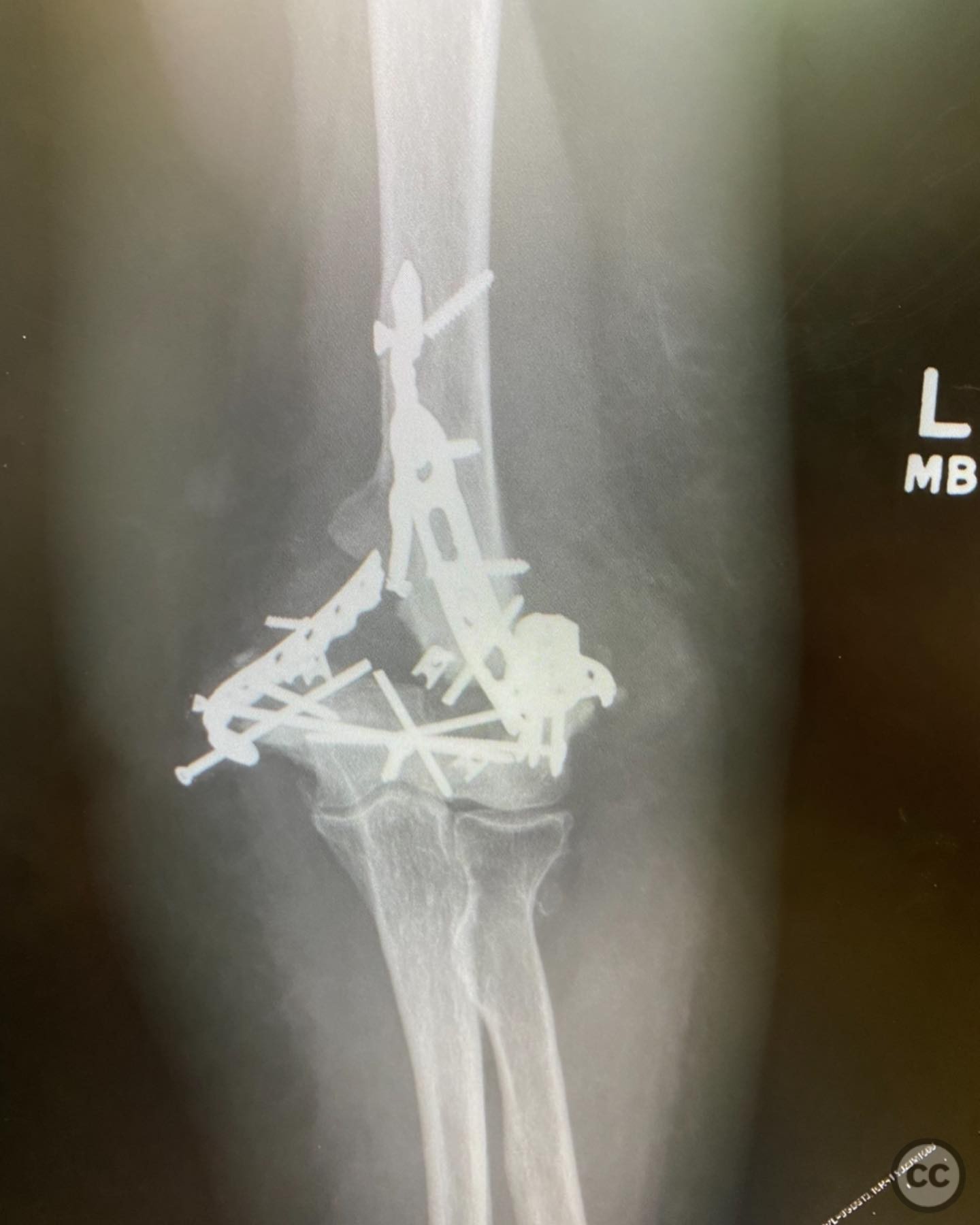 case image