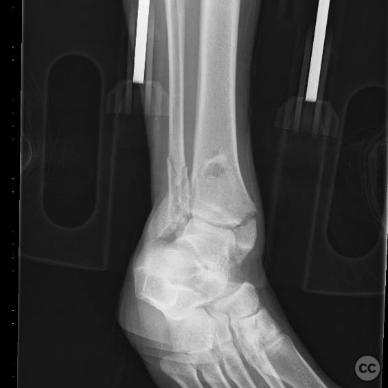 case image