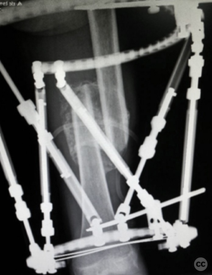 case image