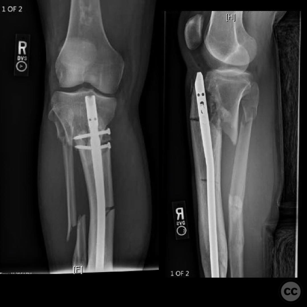 case image