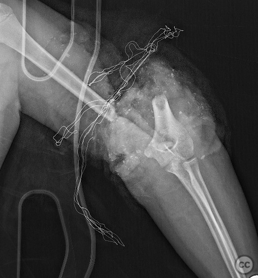 case image