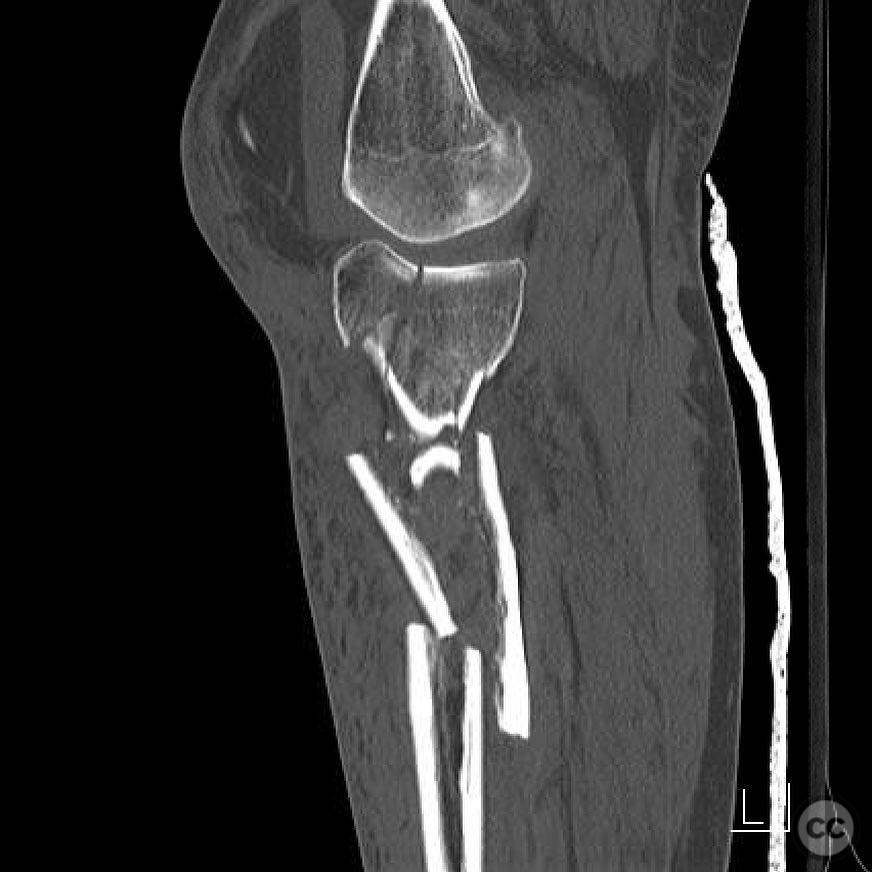 case image