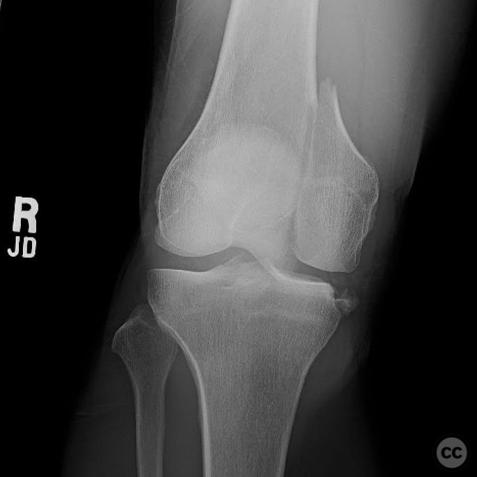 case image