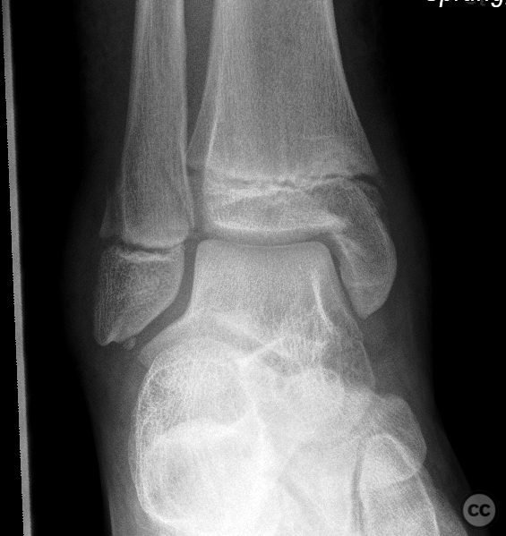 case image