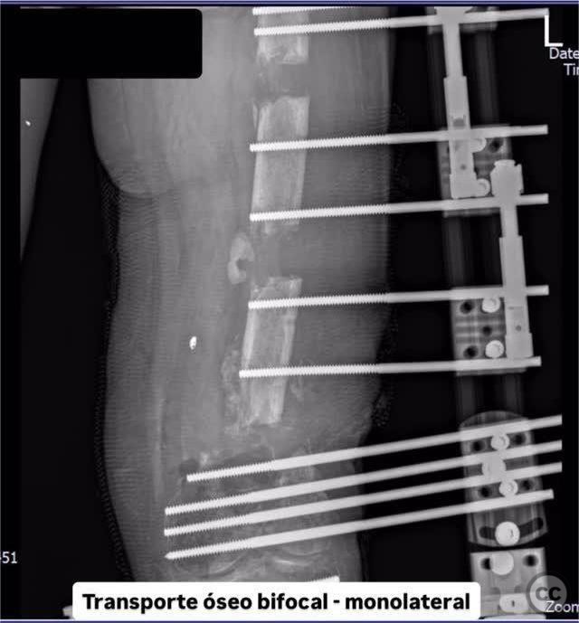 case image