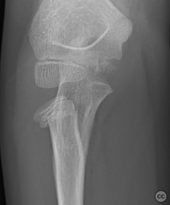 case image