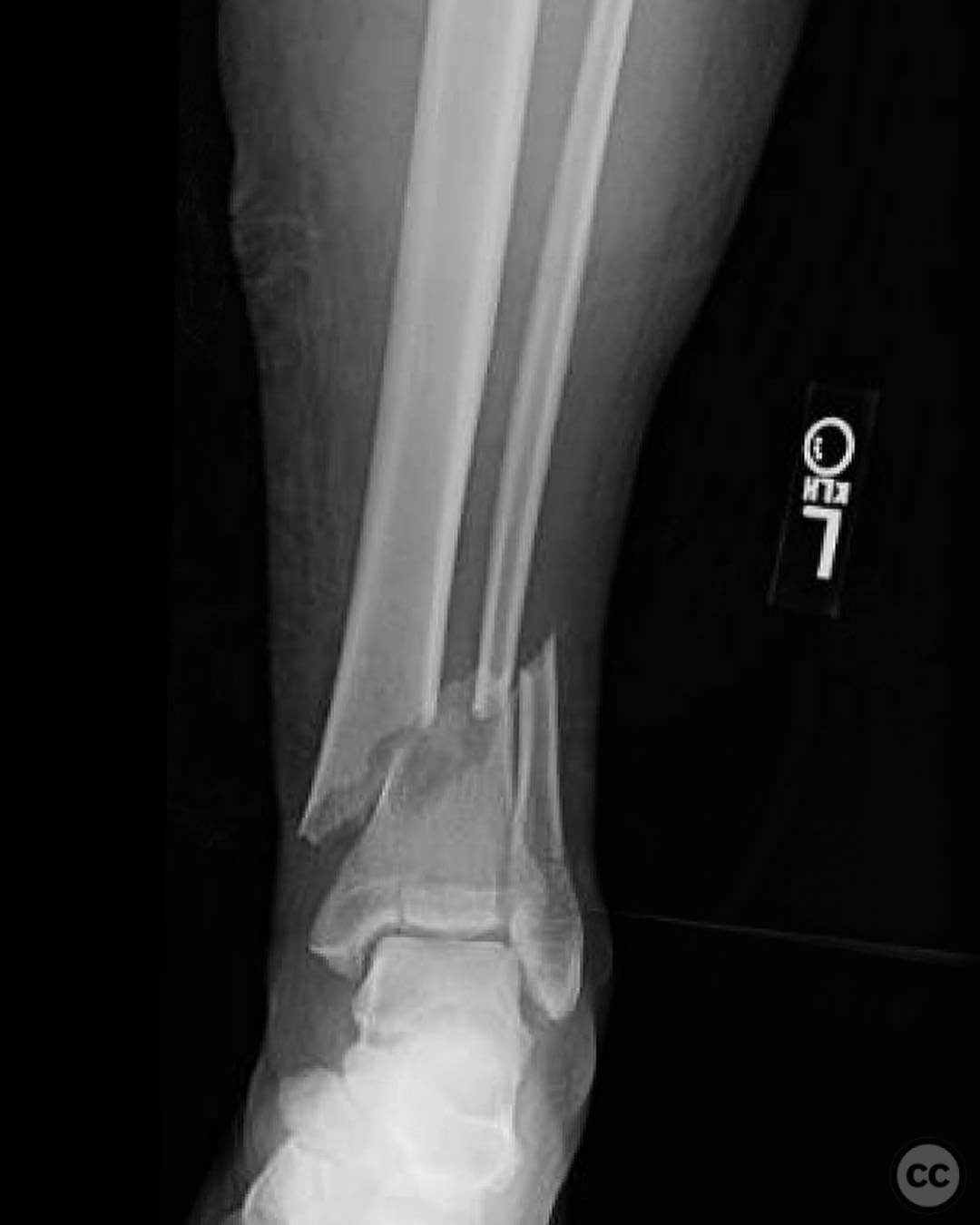 case image