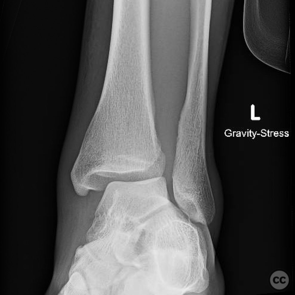 case image