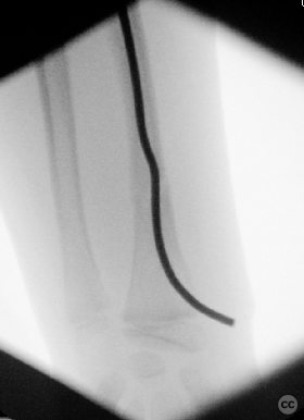 case image