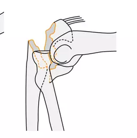 Combined - AO/OTA 21-xx