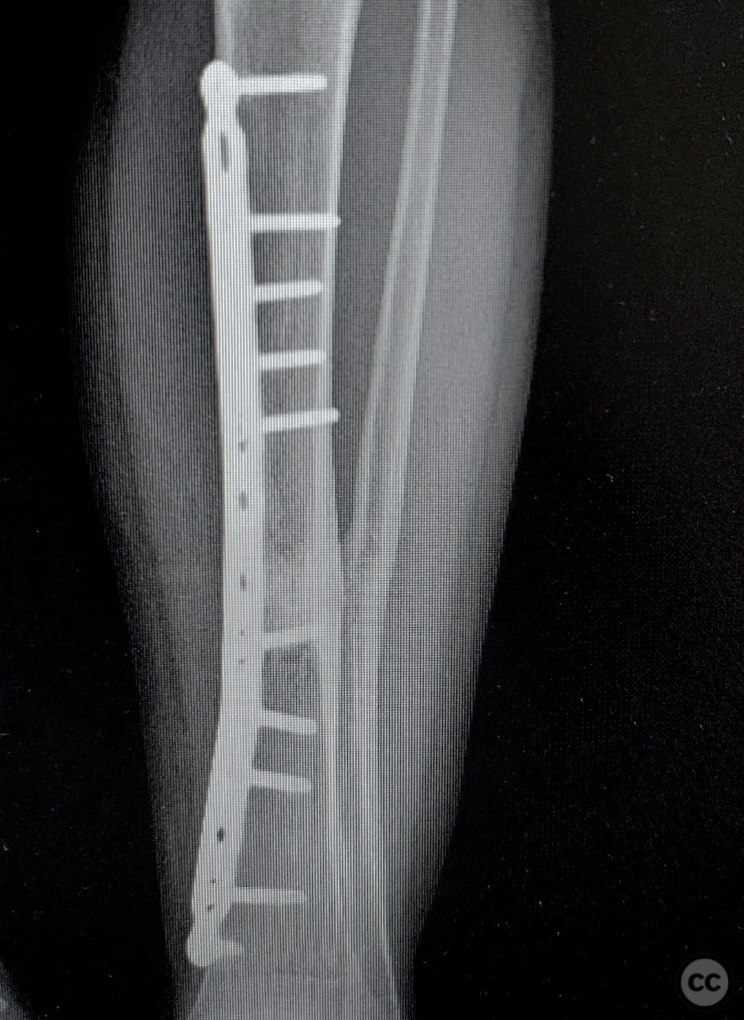 case image