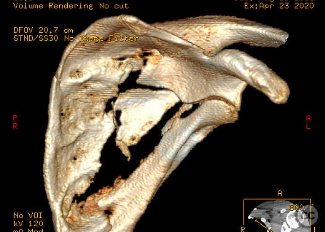 case image