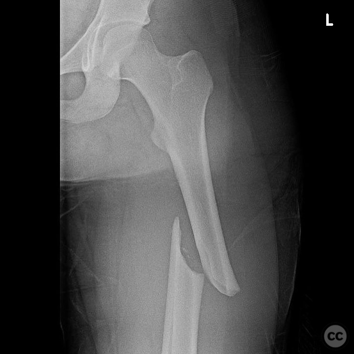 case image