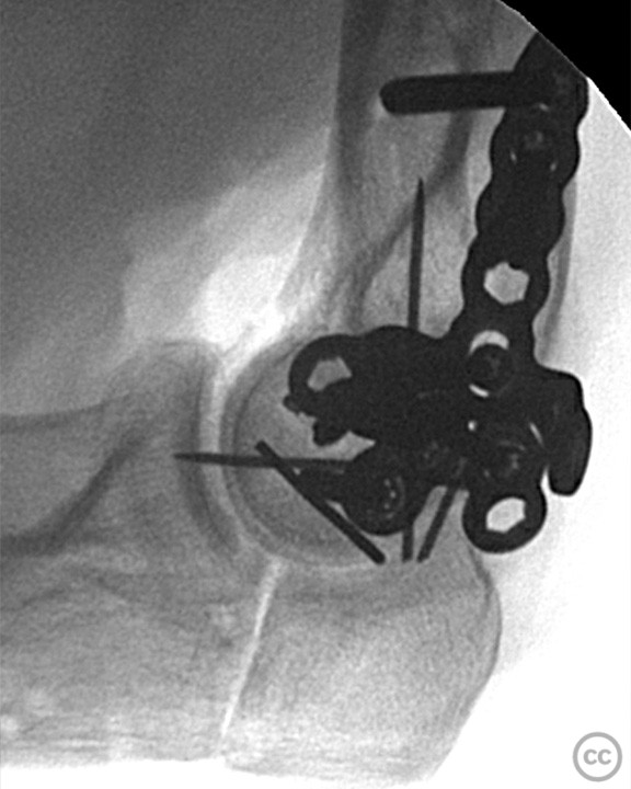 case image