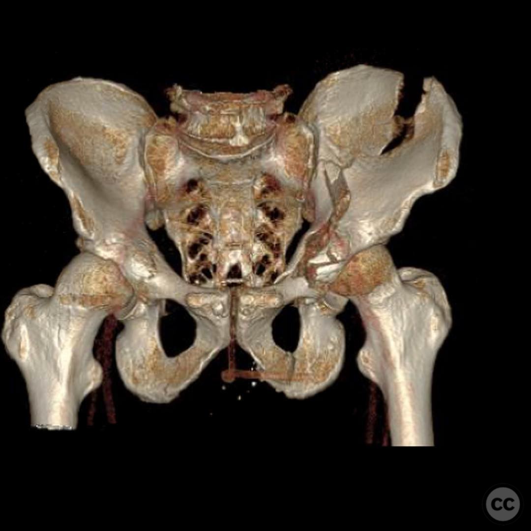 case image