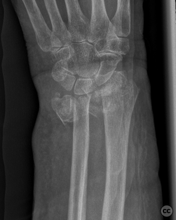 case image