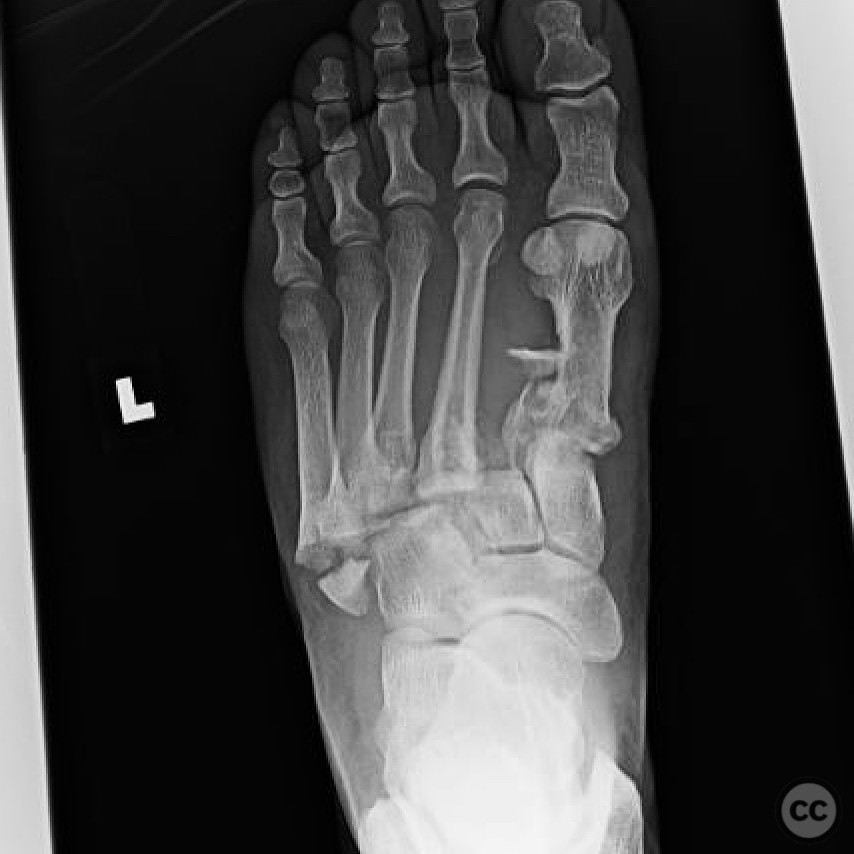 case image